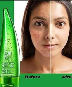 Pure Multipurpose Aloe Vera Gel For Face, Skin And Hair 120ml