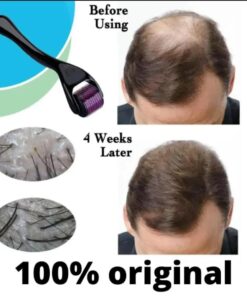 Derma Roller 0.5 mm